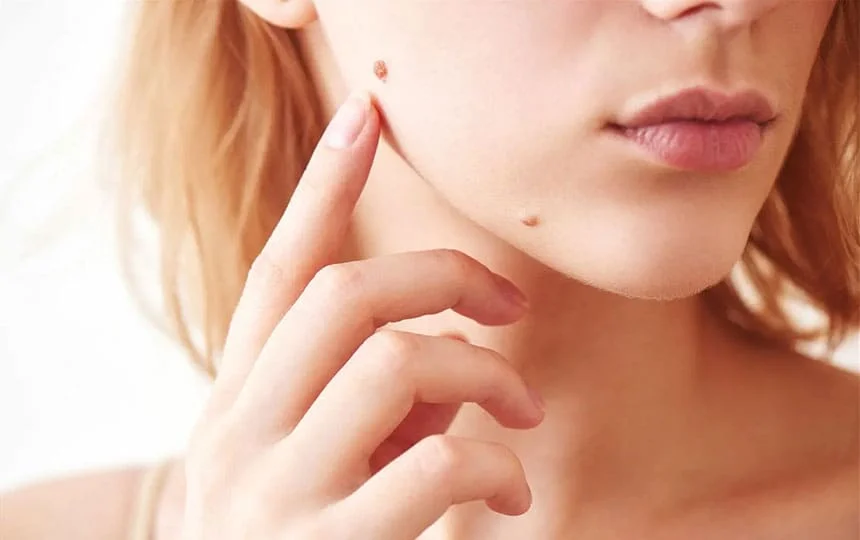 Meaning of Mole on right cheek female